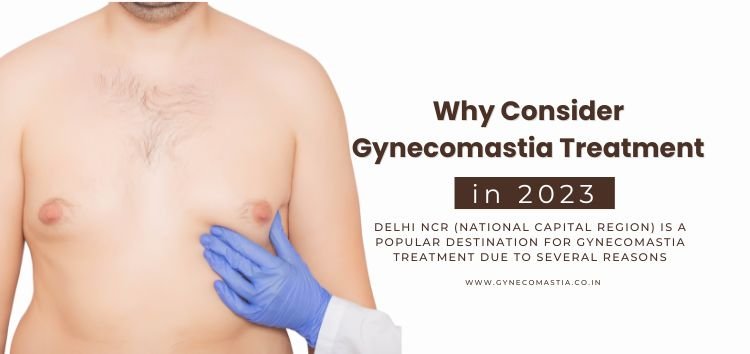 Why Consider Gynecomastia Treatment in Delhi NCR IN 2023