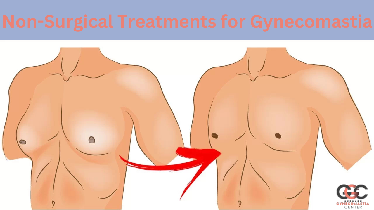 Non-surgical treatment options for gynecomastia