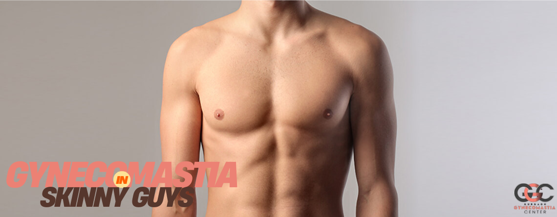 Gynecomastia in skinny men – causes and treatment options