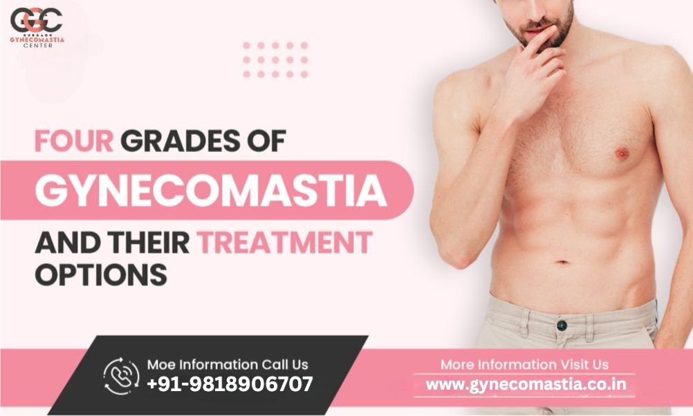 What Is Grade 3 Gynecomastia and How Is It Different from Other Stages?