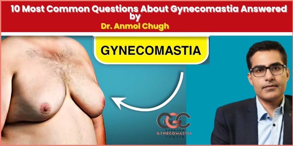Dr. Anmol Chugh explaining gynecomastia treatment options to a male patient