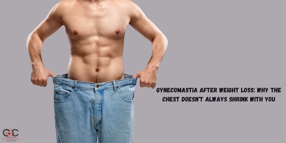 Gynecomastia After Weight Loss: Why the Chest Doesn't Always Shrink With You